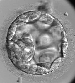 Microscopy image of a developing human embryo
